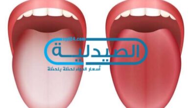 حرارة الفم وفطريات اللسان