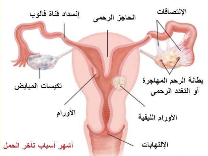 أسباب تأخر الحمل