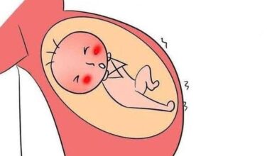 لما تتحجر البطن أثناء الحمل ؟