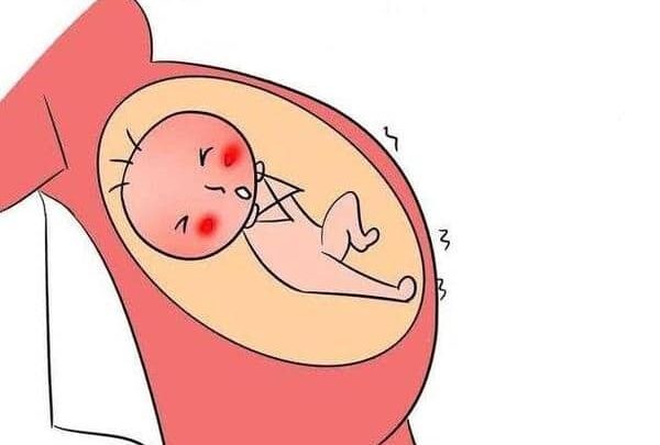 لما تتحجر البطن أثناء الحمل ؟