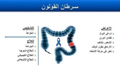 تشخيص وعلاج سرطان القولون