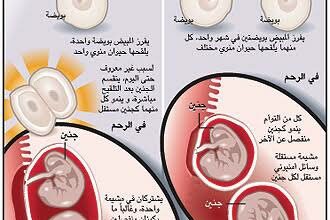 العوامل المساهمة في الحمل بتوأم