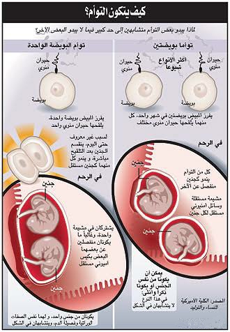 العوامل المساهمة في الحمل بتوأم