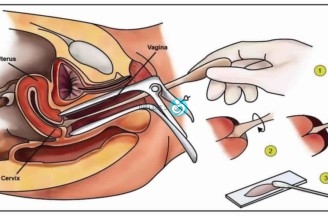 عملية جراحية في الرحم