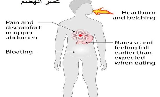 أسباب وأعراض عسر الهضم