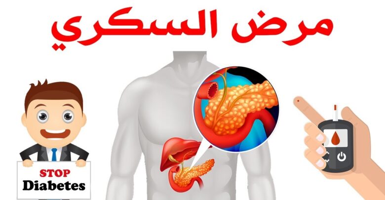 صورة للبنكرياس