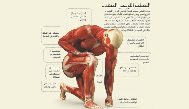 أسباب الإصابة بـ التصلب اللويحي المتعدد