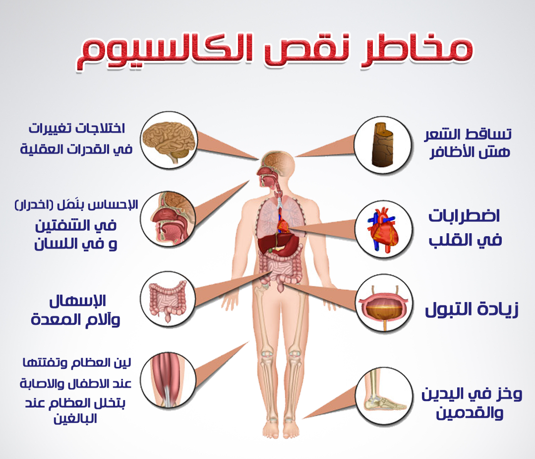 أعراض نقص الكالسيوم