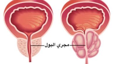 الفرق بين البروستاتا الطبيعية والبروستاتا المتضخمة