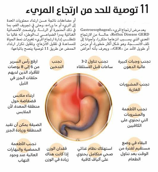 طرق الوقاية من ارتجاع المريء