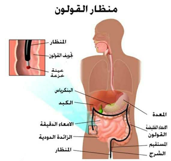 آلية عمل منظار القولون