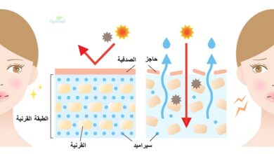 أسباب وأعراض الصدفية