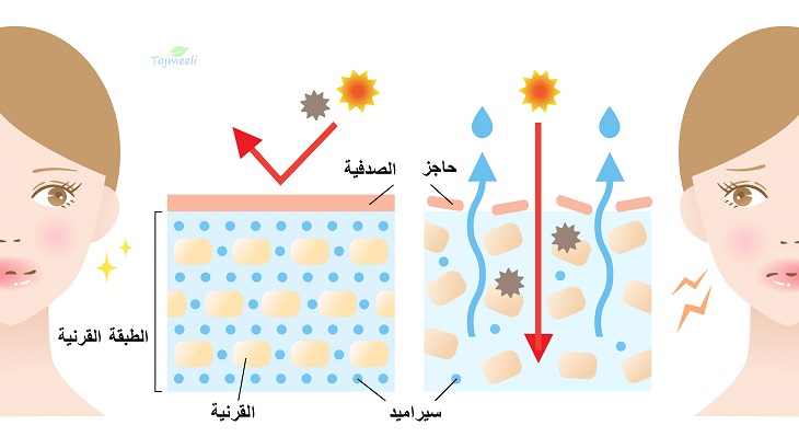 أسباب وأعراض الصدفية