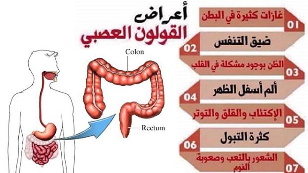 أعراض القولون العصبي