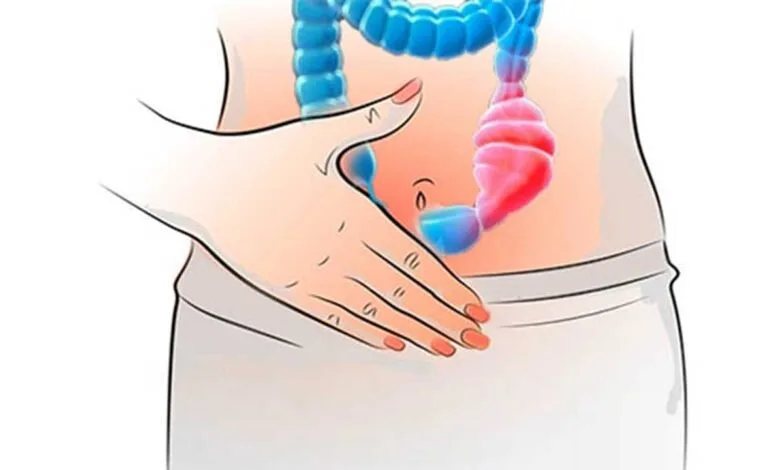 الإمساك طرق علاج الإمساك