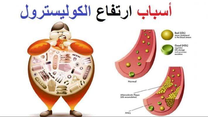 علاج ارتفاع الكوليسترول الضار