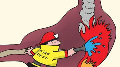أسباب وأعراض الحموضة