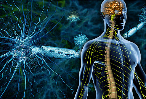 ما هو التهاب الأعصاب ؟