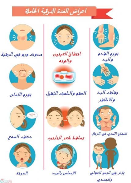 كيفية علاج أعراض قصور وخمول الغدة الدرقية