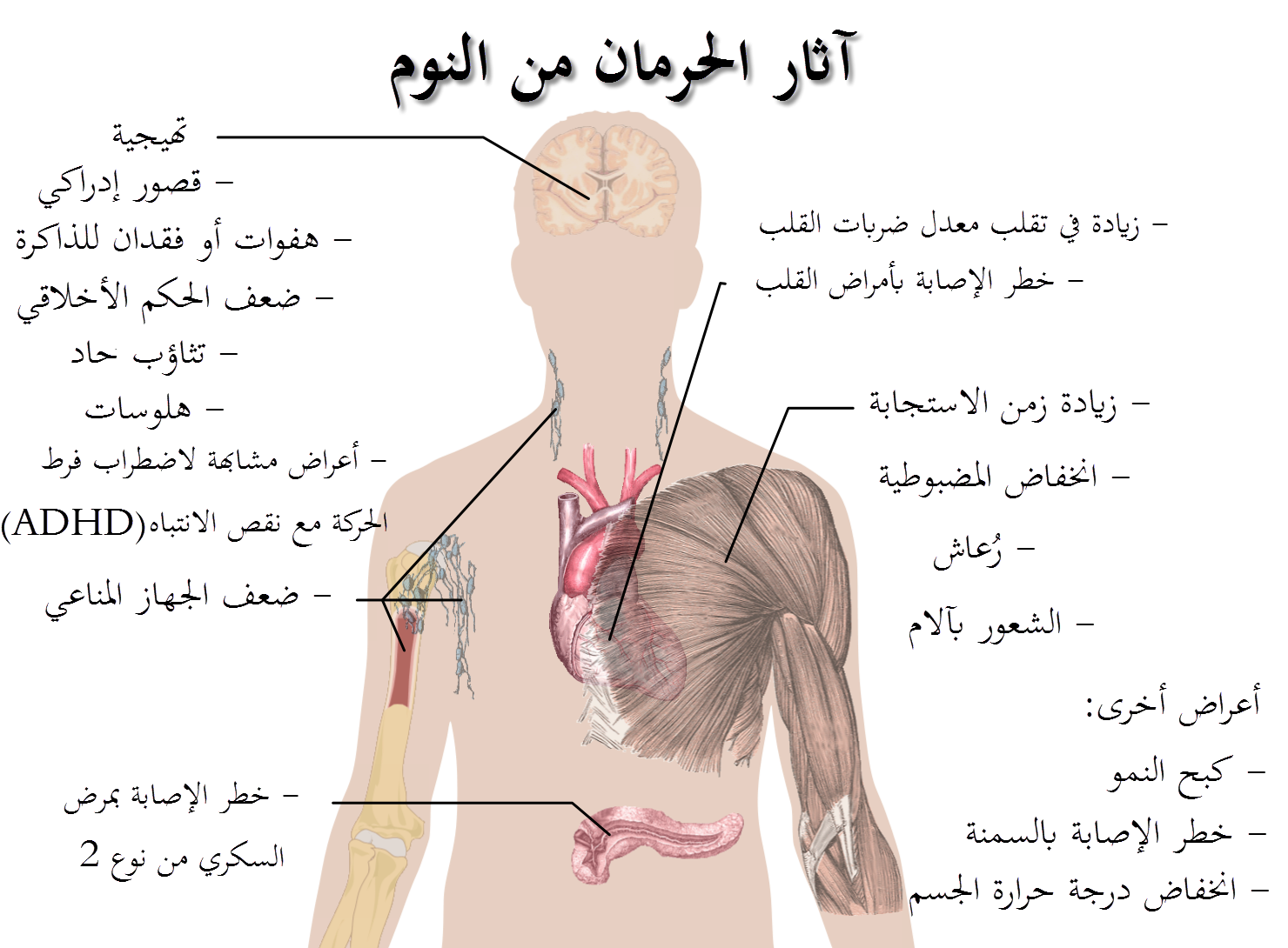 علاج الأرق وقلة النوم