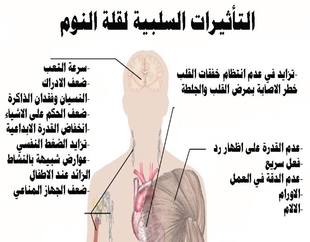 علاج الأرق وقلة النوم