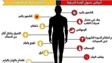 كيفية علاج أعراض قصور وخمول الغدة الدرقية