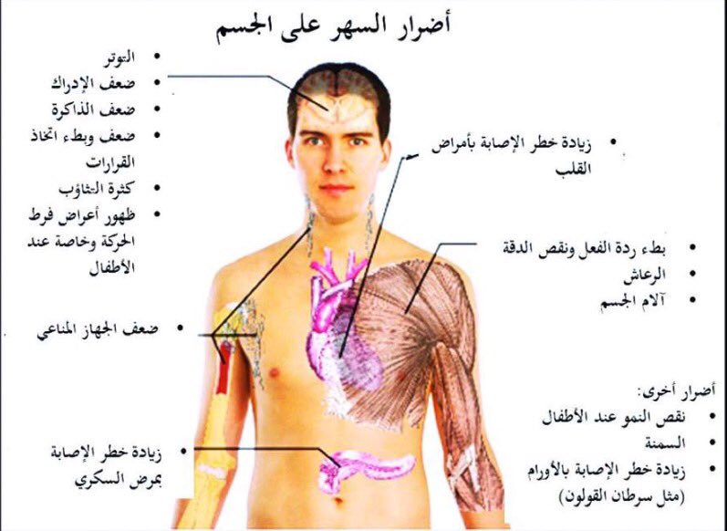 علاج الأرق وقلة النوم