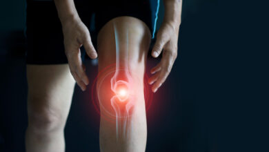 أعراض ومراحل خشونة الركبة وكيفية علاجها
