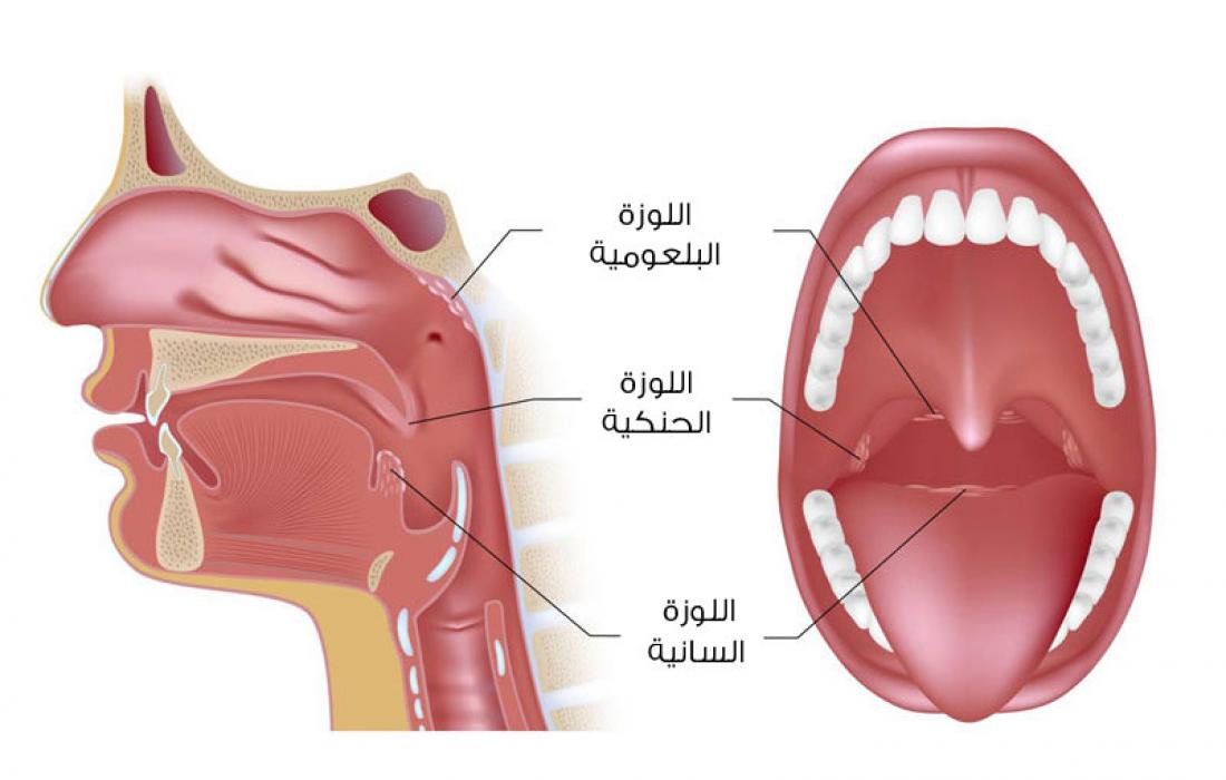 كيفية علاج أعراض التهاب اللوزتين