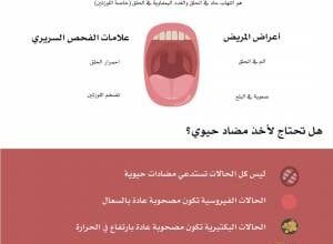 كيفية علاج التهاب الحلق