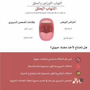 كيفية علاج التهاب الحلق