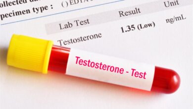 زيادة هرمون التستوستيرون وعلاج نقصه عند الرجال