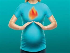 حرقة المعدة للحامل