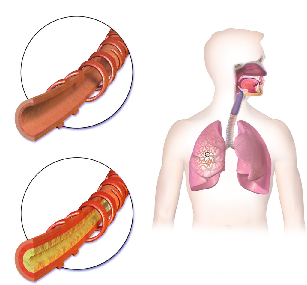 أعشاب وأدوية علاج البلغم