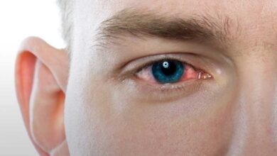 علاج أعراض التهاب العين