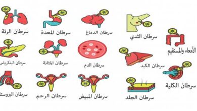 أنواع وأعراض ومراحل السرطان