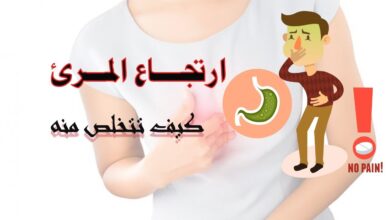 ارتجاع المرئ وعلاج الحموضة