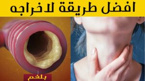 طرق طبيعية للتخلص من البلغم 