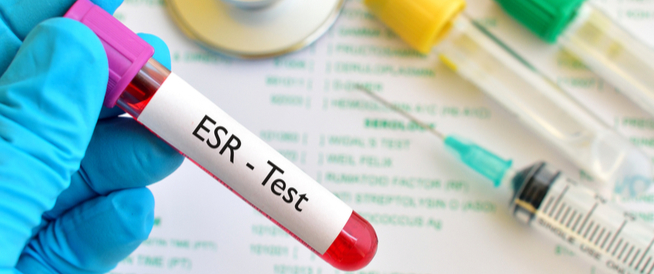 ما هو الـ ESR - Test ؟