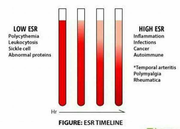 القيم المختلفة لـ تحليل ESR