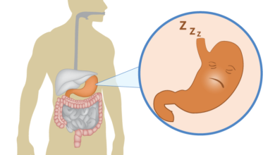 كيفية علاج أعراض عسر الهضم
