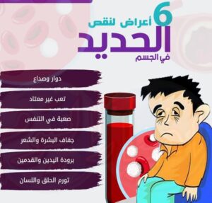 أعراض نقص الحديد