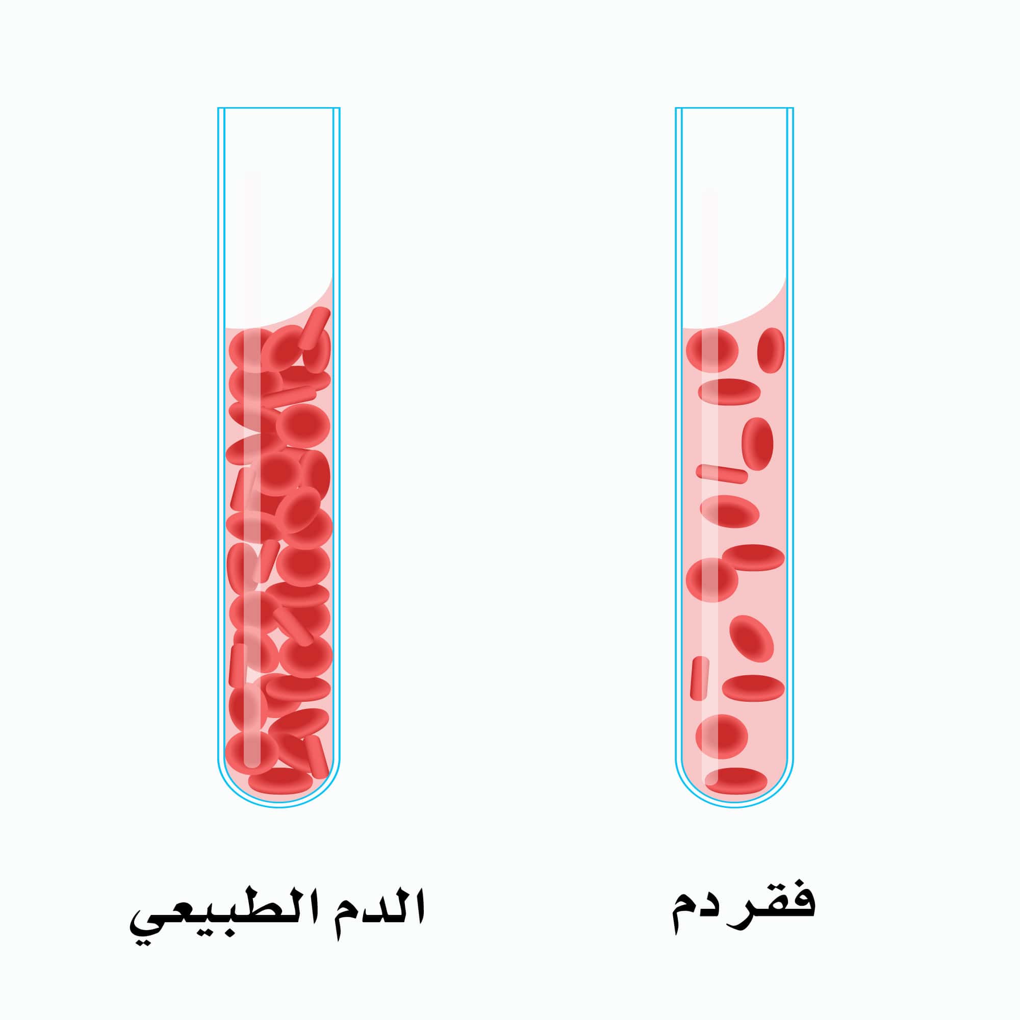 الفرق بين الدم الطبيعي والدم المصاب بـ الأنيميا
