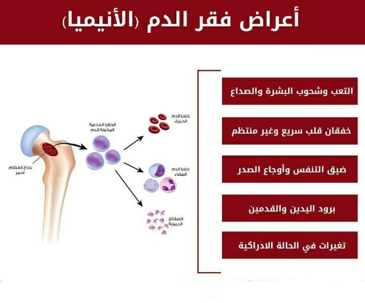ما هي أعراض فقر الدم ؟