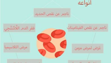 ما هي انواع فقر الدم ؟