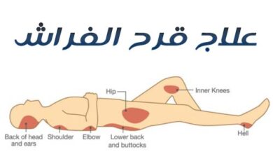 مراحل قرح الفراش وكيفية علاجها