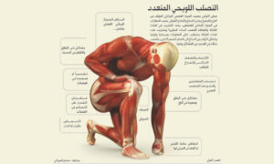 عوامل خطر المرض