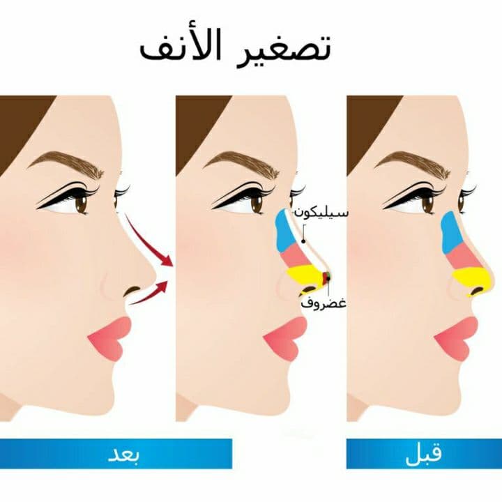 كريمات لـ تنحيف وتصغير الأنف