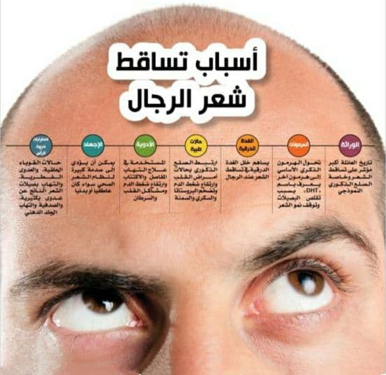 أسباب تساقط الشعر