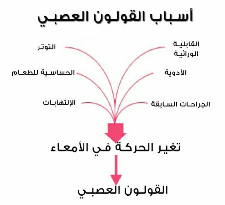 كيفية التعامل مع القولون العصبي